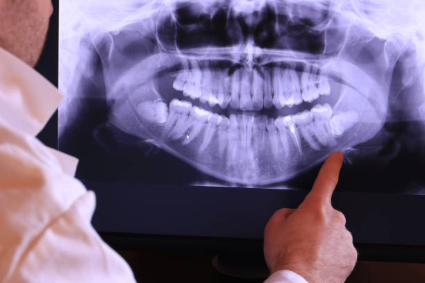 Best Emergency Dentist for Special Needs Patients in Riverton, IL