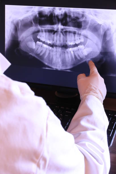 Best Emergency Dental Care for Abscessed Tooth in Riverton, IL