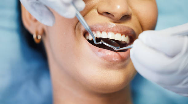Best Emergency Root Canal Treatment in Riverton, IL
