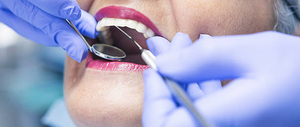 Best Emergency Dental Services for Seniors in Riverton, IL