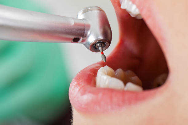 Best Emergency Dental Services for Seniors in Riverton, IL